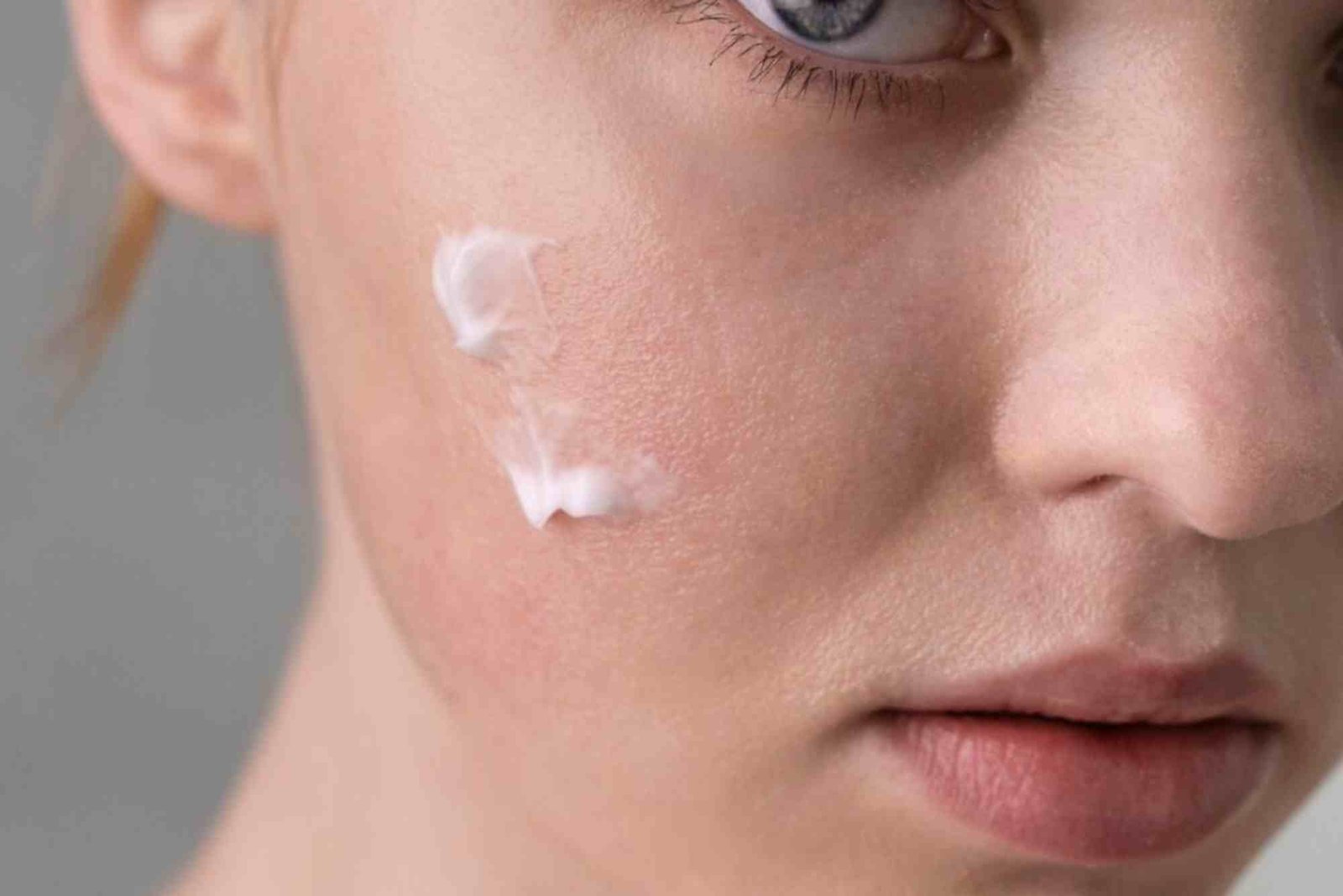 Cara Menghilangkan Bekas Jerawat dengan Skincare